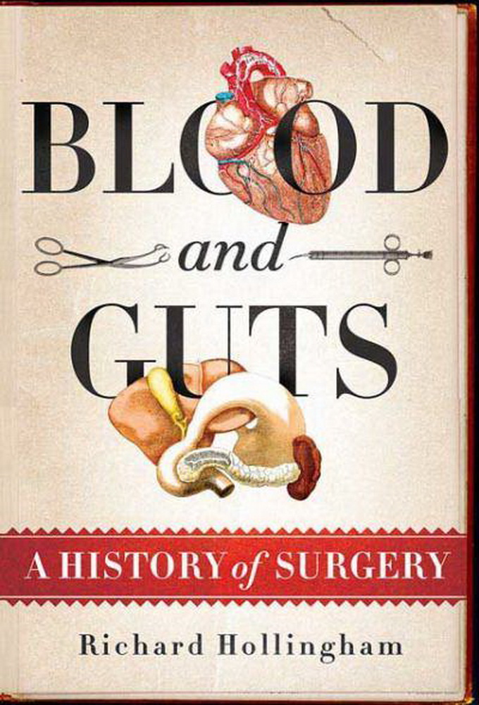 Blood and Guts: A History of Surgery series poster