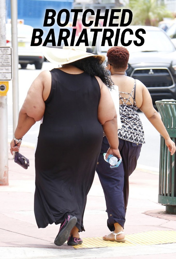 Botched Bariatrics Image