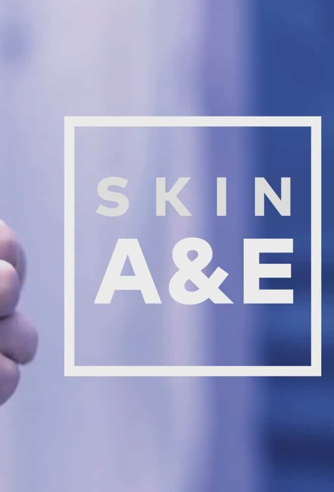 Skin A&E series poster